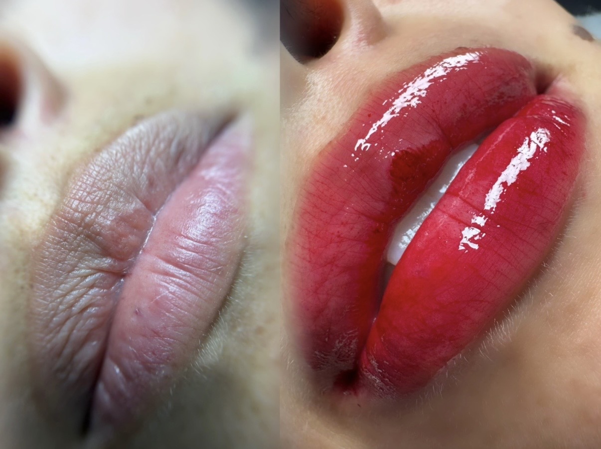 💋Hydra lips💋